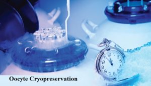 oocyte cryopreservation